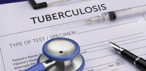 Great news!!! Overall reduction in the TB cases now in TN!!