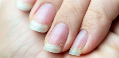 Do you know – The issue of weak nails can be due to the lack of these important nutrients!!
