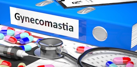 Gynecomastia-100724