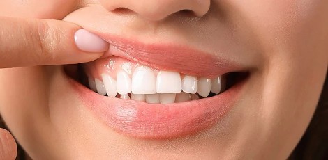 Having itchy gums – These could be the reasons, take care!!