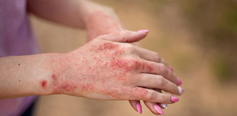 Hidden health issues that are revealed by the abnormalities in the hands!!