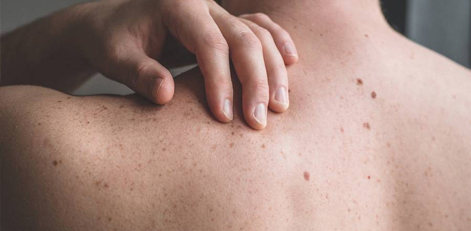 Common reasons why small irritating bumps occur on our backs!!