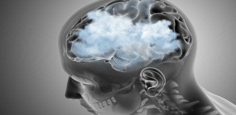 Brain Fog – Its causes, treatments, foods to eat etc!!