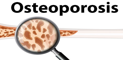 Low levels of testosterone can lead to fractures in men, take care!!