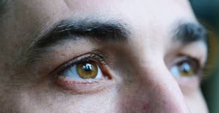 These eye symptoms would reveal that your kidneys are not functioning well or kidney damage!!