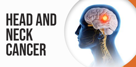 Important information regarding head & neck cancers!!