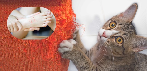 We can get this serious disease CSD through cat scratches, take care!!