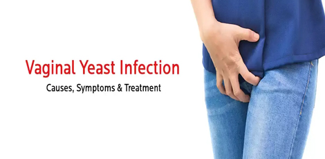 Women can get yeast infection by these surprising habits, take care!!