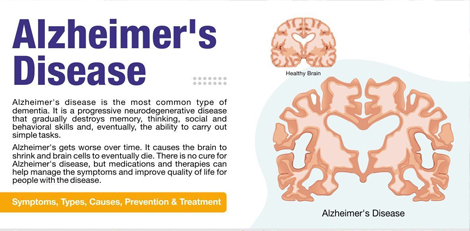 Brain would age faster and we could get Alzheimers disease, Parkinsons disease etc due to these nutrient deficiencies!!