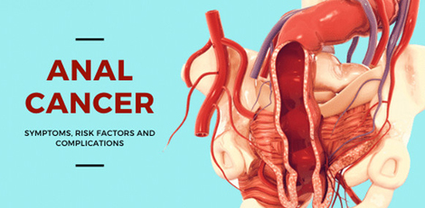 Be careful about these symptoms of anal cancer!!