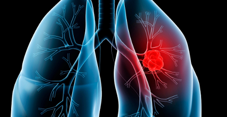 These signs would reveal the presence of lung diseases in us, take care!!