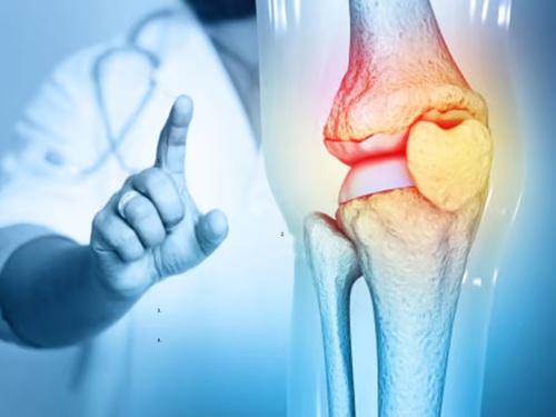 Bone Health Tips by Dr. Arun Kumar | Strengthen Your Bones Early & Prevent Joint Pain