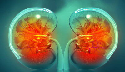 Chronic Kidney Disease: Symptoms, Risk Factors & Prevention Tips