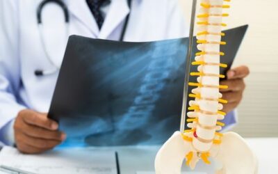 Simple Habits That Can Help Keep Your Bones Strong
