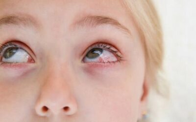 Eye Infection: Symptoms, Causes, Treatment & Prevention