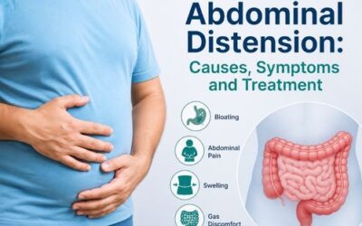 Abdominal Distension: Causes, Symptoms and Treatment