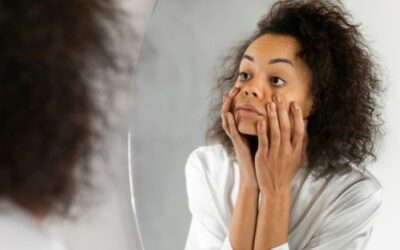 Dark Circles Under Eyes: Causes, Home Remedies and Treatment