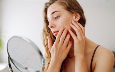 How to Prevent Dry Skin in Winter: Simple Skin Care Tips
